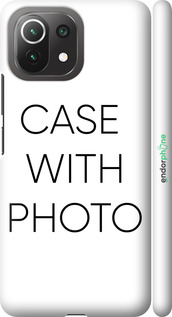 3D plastic matte case 'Photo case' for Xiaomi Mi 11 Lite -  image 1
