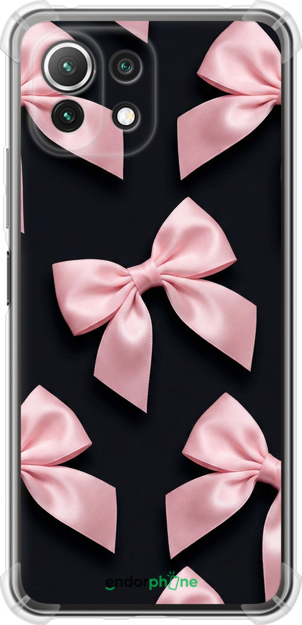 Силикон с усиленными углами чехол Coquette Ribbons Dark Coquette для Xiaomi Mi 11 Lite - 6767sp-2281 изображение 