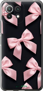 Силиконовый чехол Coquette Ribbons Dark Coquette для Xiaomi Mi 11 Lite - 6767u-2281 изображение 