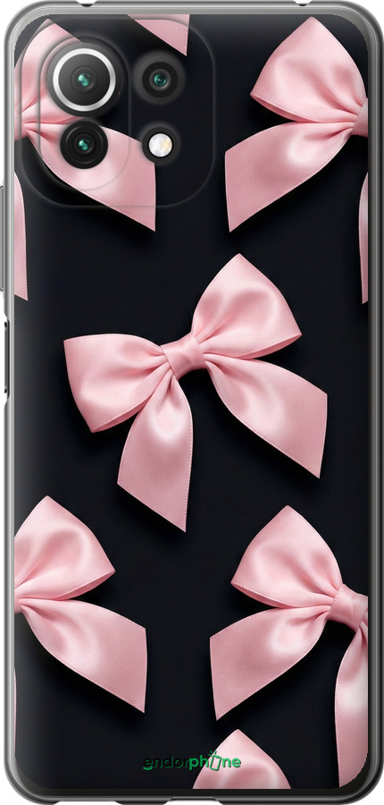 Силиконовый чехол Coquette Ribbons Dark Coquette для Xiaomi Mi 11 Lite - 6767u-2281 изображение 