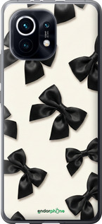 Силіконовий чехол Dark Coquette для Xiaomi Mi 11 - 6765u-2253 изображение 