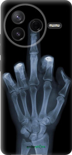 Силиконовый чехол Рука через рентген для Xiaomi POCO F7 Pro - 1007u-4085 изображение 
