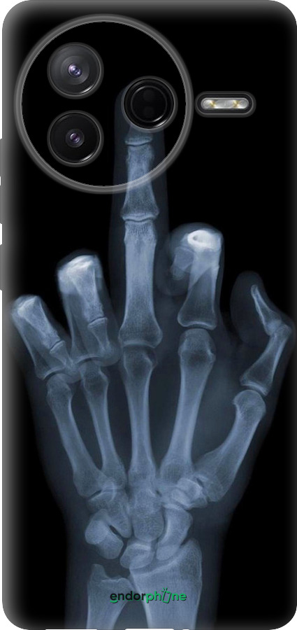 Силиконовый чехол Рука через рентген для Xiaomi POCO F7 Pro - 1007u-4085 изображение 