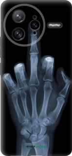 Силіконовий чехол Рука через рентген для Xiaomi Poco F7 Ultra - 1007u-4086 изображение 