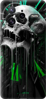 Силіконовий чехол Череп-годинник для Xiaomi Redmi K80 Pro - 4100u-4145 изображение 