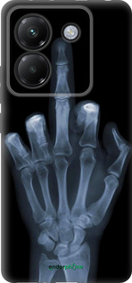 Силиконовый чехол Рука через рентген для Xiaomi Poco M7 Pro 5G - 1007u-3942 изображение 