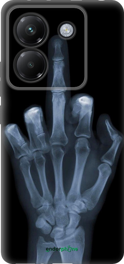 Силиконовый чехол Рука через рентген для Xiaomi Poco M7 Pro 5G - 1007u-3942 изображение 