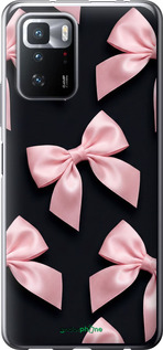 Силиконовый чехол 'Coquette Ribbons Dark Coquette' для Xiaomi Redmi Note 10 Pro 5G изображение 3