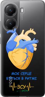Силиконовый чехол Сердце v2 для Xiaomi Turbo 4 - 5296u-4013 изображение 