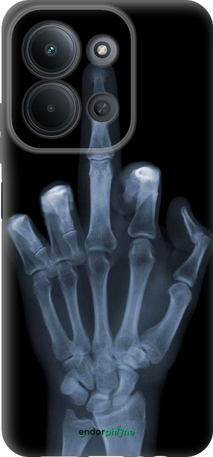 Силиконовый чехол Рука через рентген для Xiaomi POCO C85 4G - 1007u-4233 изображение 