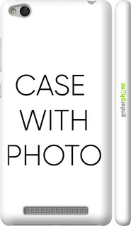 matte 3D plastic case case 'Photo case' for Xiaomi Redmi 3 -  image 1