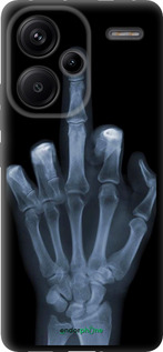TPU чехол Рука через рентген для Xiaomi Redmi Note 13 Pro Plus 5g - 1007b-3400 изображение 