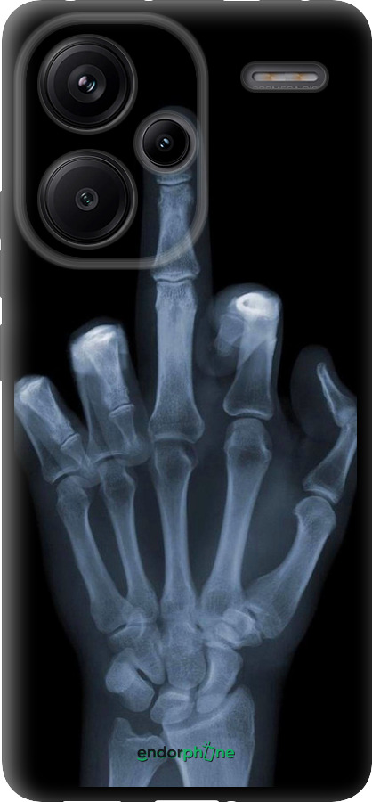 TPU чехол Рука через рентген для Xiaomi Redmi Note 13 Pro Plus 5g - 1007b-3400 изображение 