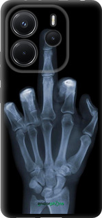 TPU чехол Рука через рентген для Xiaomi Redmi Note 14 4G - 1007b-3903 изображение 