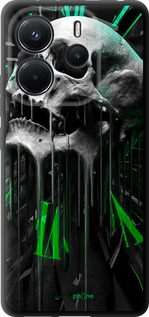 TPU чехол Череп-часы для Xiaomi Redmi Note 14 4G - 4100b-3903 изображение 