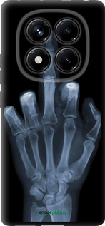 TPU чехол Рука через рентген для Xiaomi Redmi Note 14 Pro 4G - 1007b-3808 изображение 