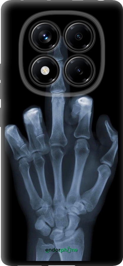 TPU чехол Рука через рентген для Xiaomi Redmi Note 14 Pro 4G - 1007b-3808 изображение 