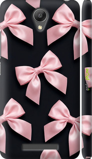 3D пластиковий матовий чехол Coquette Ribbons Dark Coquette для Xiaomi Redmi Note 2 - 6767m-96 изображение 