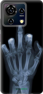 Силіконовий чехол Рука через рентген для ZTE Blade V50 Vita - 1007u-3813 изображение 