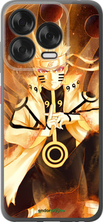 Силиконовый чехол № 5441 для ZTE Nubia V70 Design - 5441u-4084 изображение 