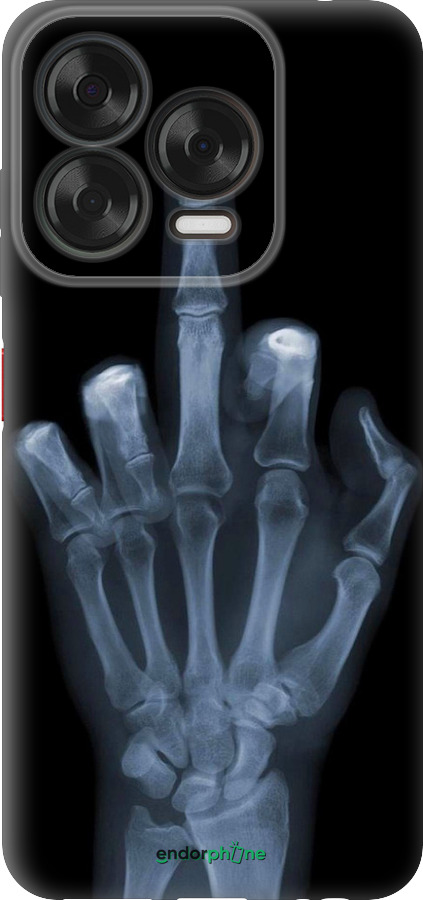 Силиконовый чехол Рука через рентген для ZTE Nubia V70 Design - 1007u-4084 изображение 