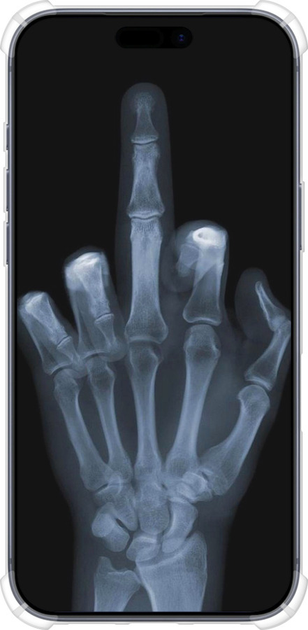 Силикон с усиленными углами чехол Рука через рентген для Apple iPhone 17 PRO - 1007sp-4030 изображение 