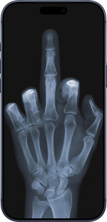 Силиконовый чехол Рука через рентген для Apple iPhone 17 PRO - 1007u-4030 изображение 