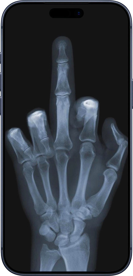 Силиконовый чехол Рука через рентген для Apple iPhone 17 PRO - 1007u-4030 изображение 