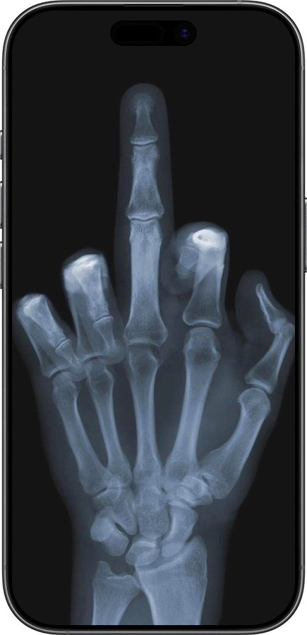 TPU чехол Рука через рентген для Apple iPhone 17 - 1007b-4031 изображение 