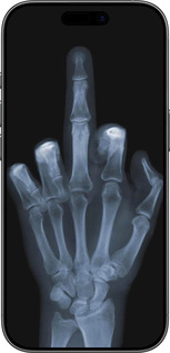 Силіконовий чехол Рука через рентген для Apple iPhone 17 - 1007u-4031 изображение 