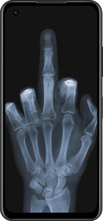 Силиконовый чехол Рука через рентген для Asus Zenfone 9 - 1007u-2842 изображение 