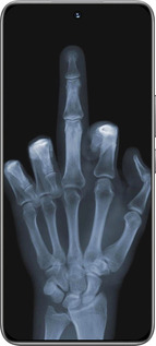 TPU чехол Рука через рентген для Huawei Honor 200 - 1007b-3731 изображение 