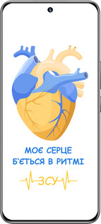 TPU чехол Сердце v2 для Huawei Honor 200 - 5296b-3731 изображение 