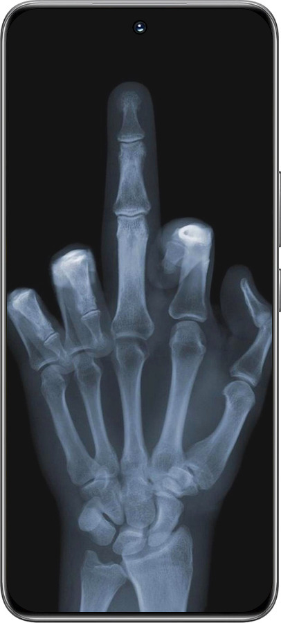 TPU чехол Рука через рентген для Huawei Honor 200 - 1007b-3731 изображение 