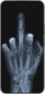 Силиконовый чехол Рука через рентген для Huawei Honor 400 5G - 1007u-4017 изображение 