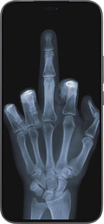 Силиконовый чехол Рука через рентген для Huawei Honor 400 Lite 5G - 1007u-3993 изображение 