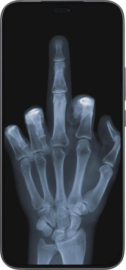 Силиконовый чехол Рука через рентген для Huawei Honor 400 Lite 5G - 1007u-3993 изображение 