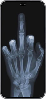 Силиконовый чехол Рука через рентген для Huawei Honor 400 PRO 5G - 1007u-4036 изображение 