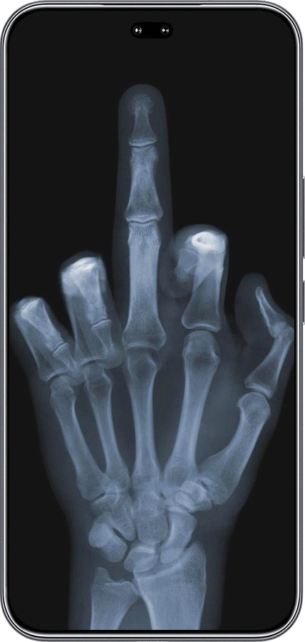 Силиконовый чехол Рука через рентген для Huawei Honor 400 PRO 5G - 1007u-4036 изображение 