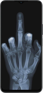 Силиконовый чехол Рука через рентген для Huawei Honor X8 5G - 1007u-4149 изображение 