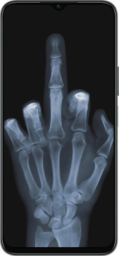 Силиконовый чехол Рука через рентген для Huawei Honor X8 5G - 1007u-4149 изображение 