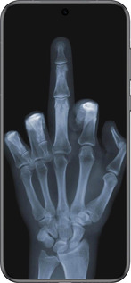 Силиконовый чехол Рука через рентген для Huawei Pura 70 - 1007u-3703 изображение 