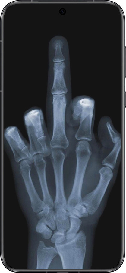 Силиконовый чехол Рука через рентген для Huawei Pura 70 - 1007u-3703 изображение 