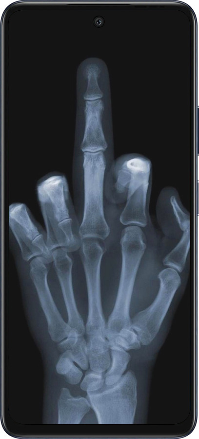 Силіконовий чехол Рука через рентген для Infinix Hot 50 5G - 1007u-3795 изображение 