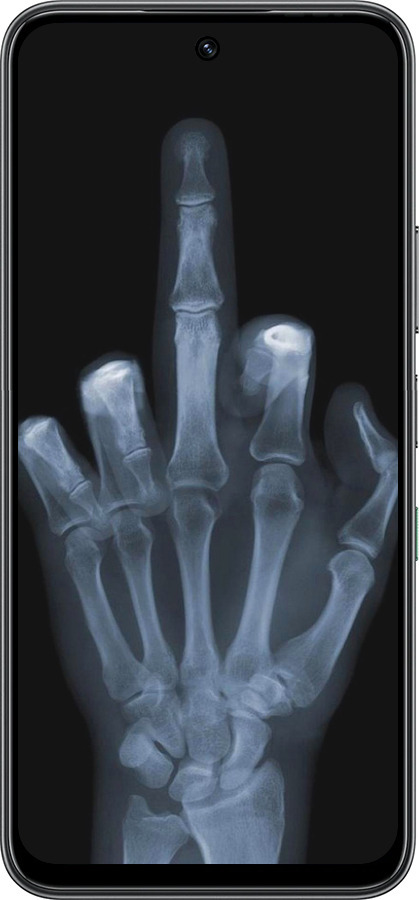 Силиконовый чехол Рука через рентген для Infinix Hot 60 5G / Hot 60i 4G - 1007u-4114 изображение 