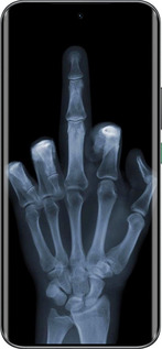 Силіконовий чехол Рука через рентген для Infinix Hot 60 Pro+ - 1007u-4125 изображение 