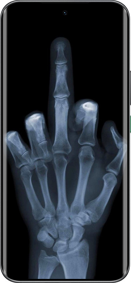 Силіконовий чехол Рука через рентген для Infinix Hot 60 Pro+ - 1007u-4125 изображение 