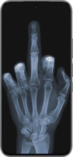 Силіконовий чехол Рука через рентген для Infinix Hot 60 Pro - 1007u-4126 изображение 