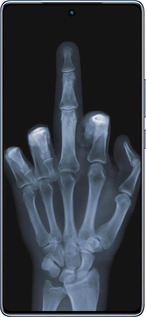 TPU чехол Рука через рентген для Infinix Note 40 - 1007b-3707 изображение 