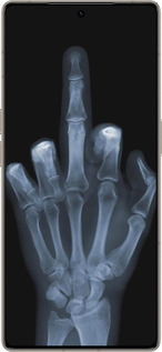 Силіконовий чехол Рука через рентген для Infinix Note 50 Pro+ - 1007u-4041 изображение 